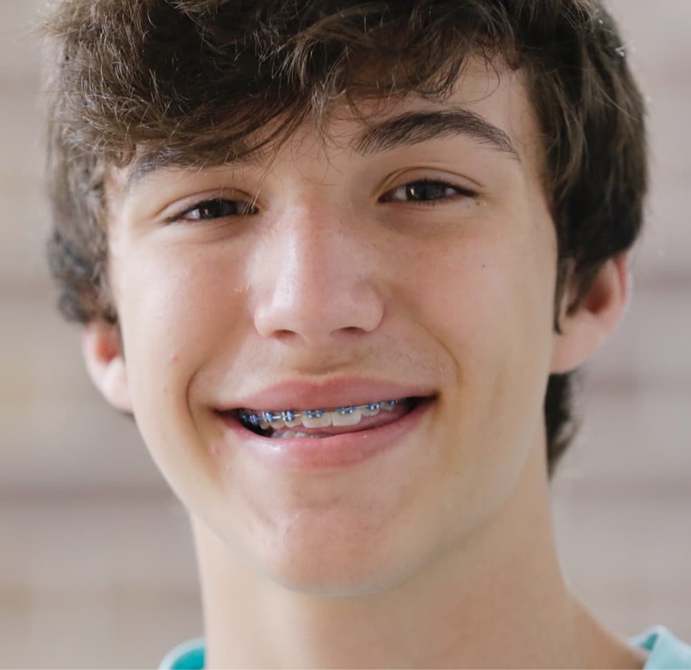 teen wearing traditional metal braces