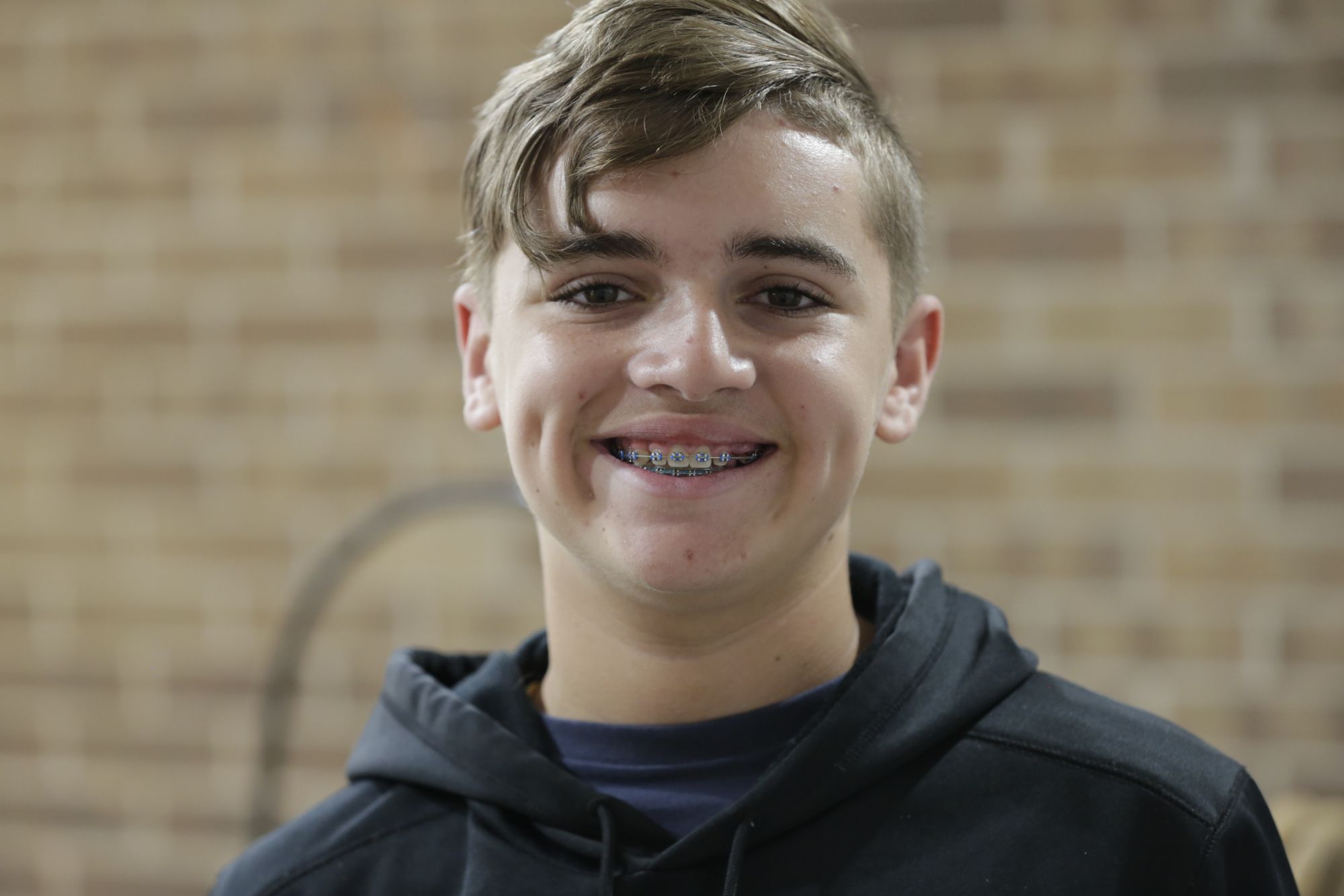 Braces Bonita Springs Norton Orthodontics Braces & Invisalign