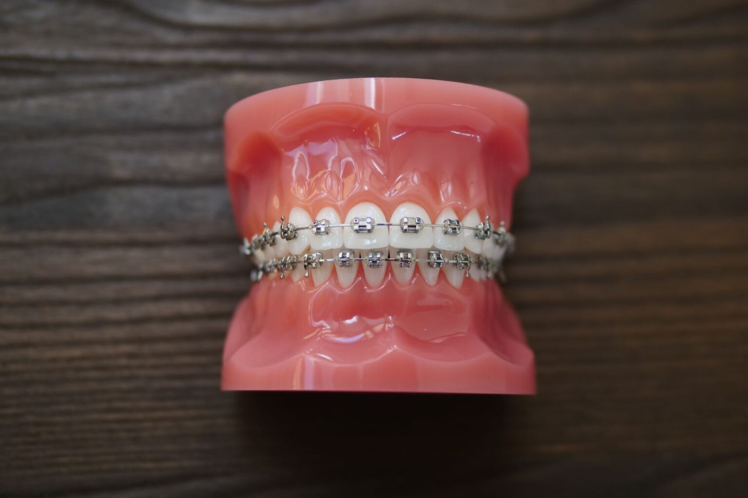 Metal Braces Treatment Norton Orthodontics Braces Cape Coral