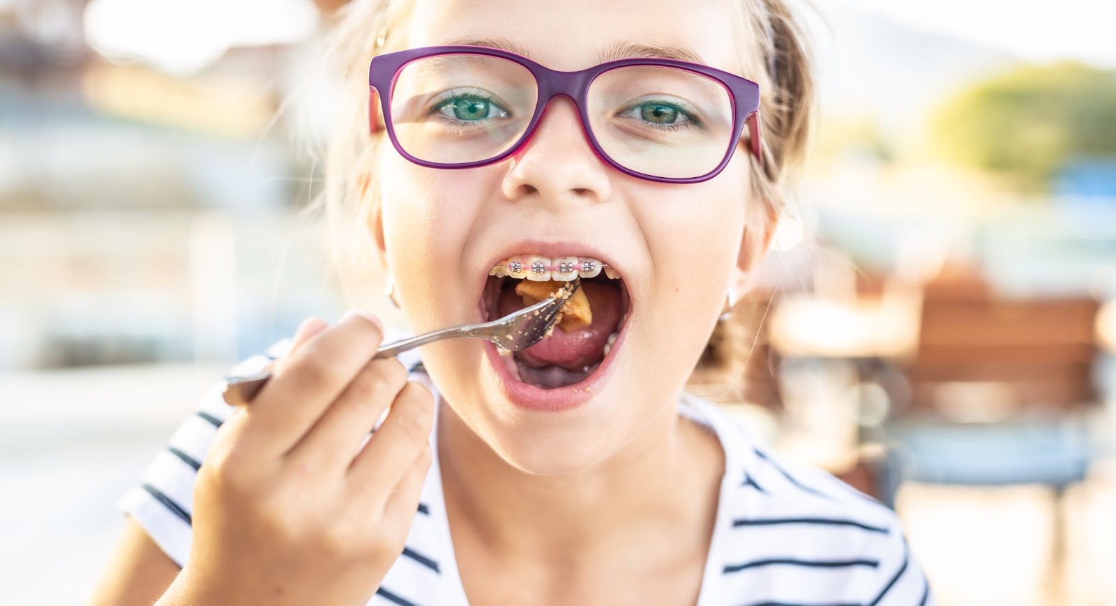 Your Guide to Healthy Dining in Charlotte While Wearing Braces